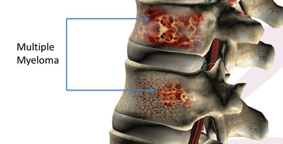 Spinal Column